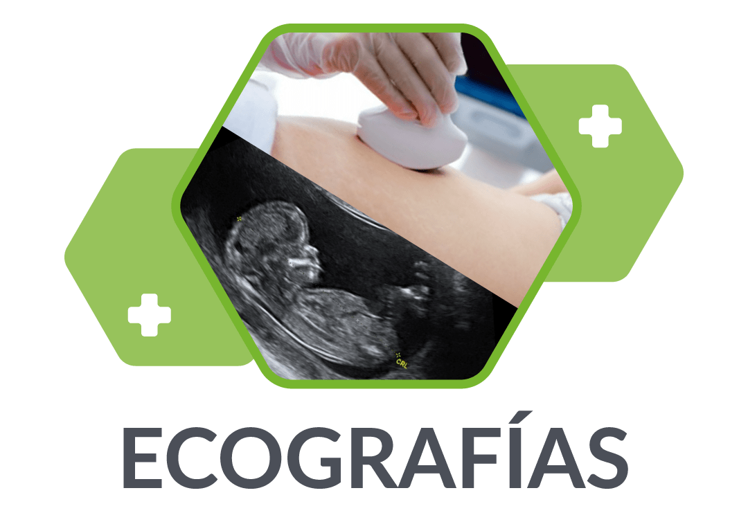 ecografias-ginecologicas-y-obstetricas
